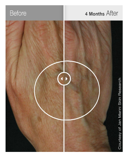 Антивозрастной корректирующий крем для рук Jan Marini ReNu Corrective Hand Complex, 28 мл