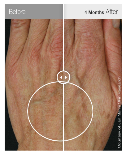 Антивозрастной корректирующий крем для рук Jan Marini ReNu Corrective Hand Complex, 28 мл